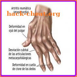 Remedios Caseros Artritis icon